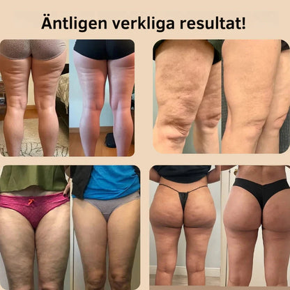 3D Formande Anti-Cellulit Leggings